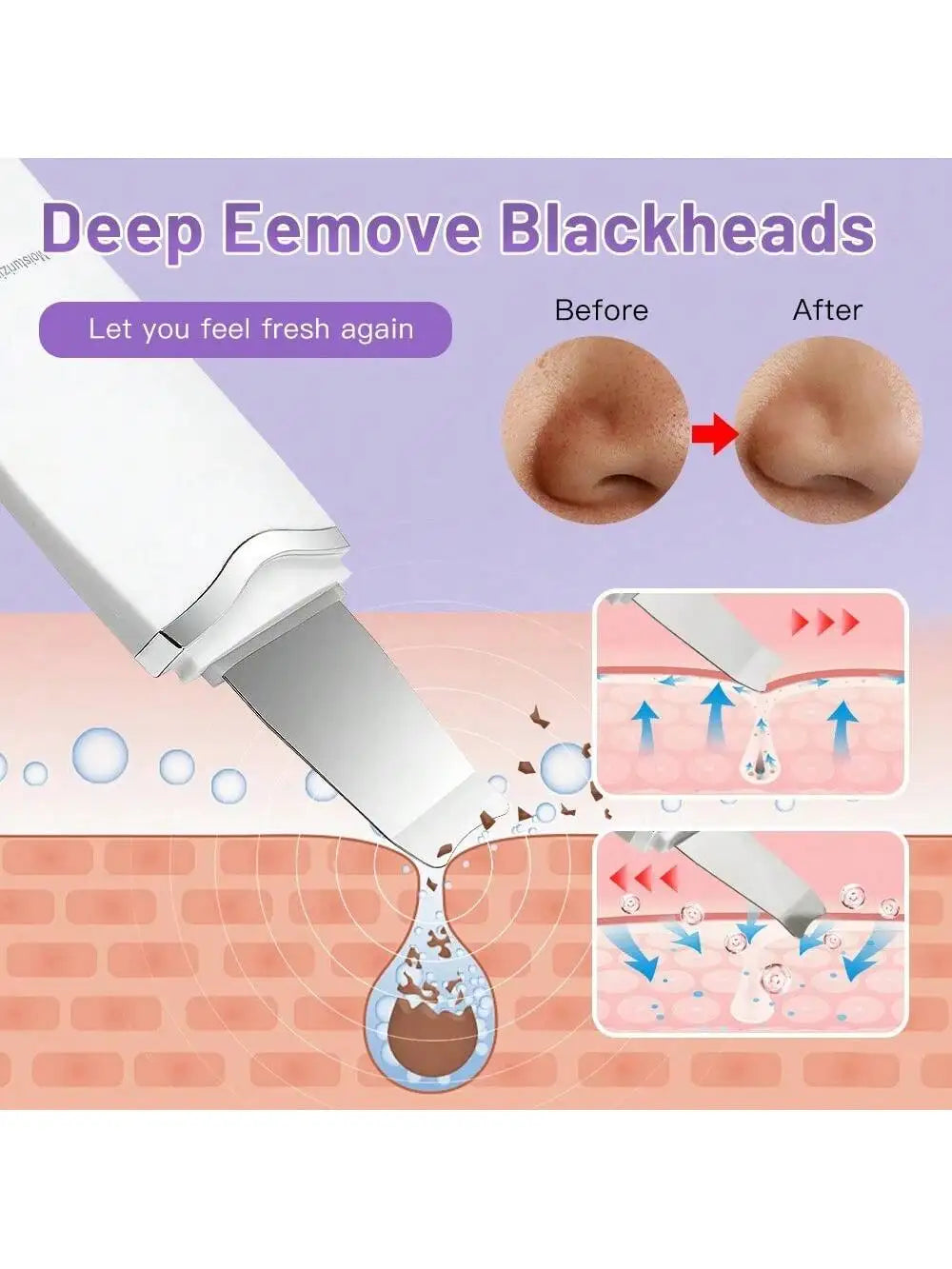 2026 Ultrasonic Skin Scraper Pore Cleaning Facial Deep Cleaning Machine Suitable for Female and Male Rechargeable