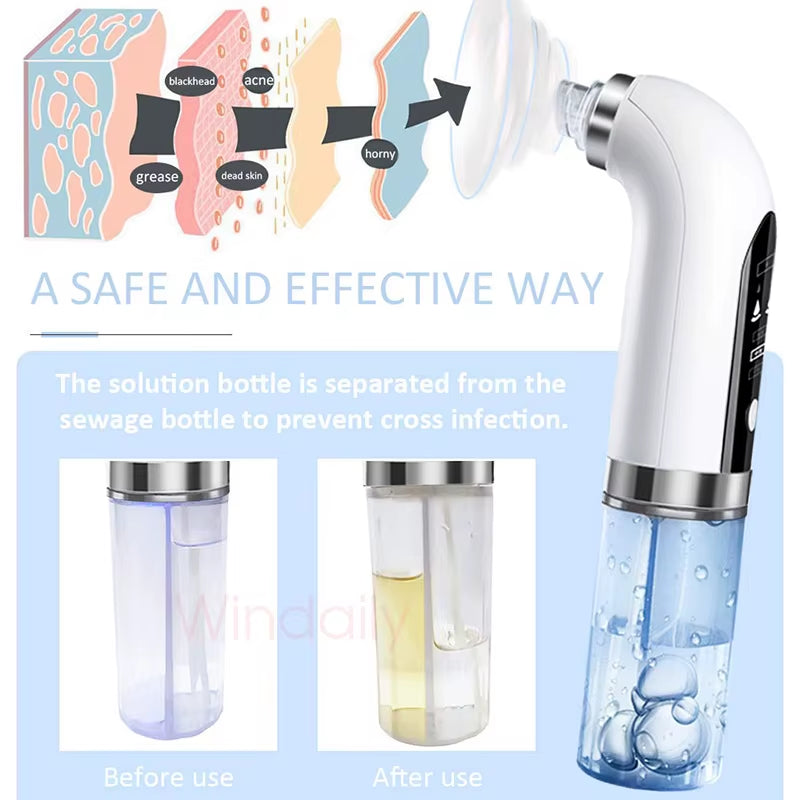 2026 Blackhead Remover Pore Vacuum Cleaner Electric Micro Small Bubble Facial Cleasing Machine USB Rechargeable Beauty Device